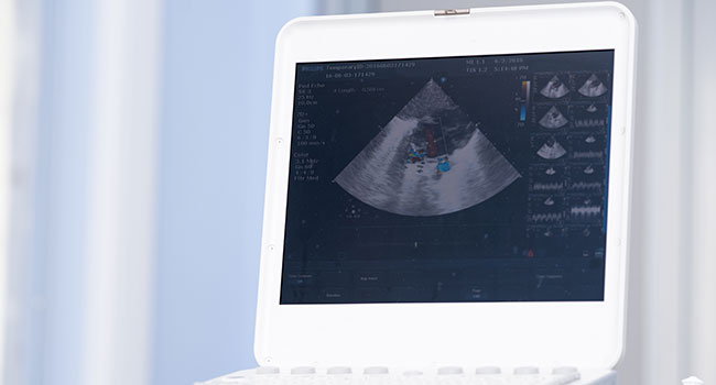 Ecocardiograma