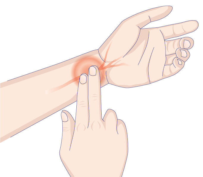 Pulso radial