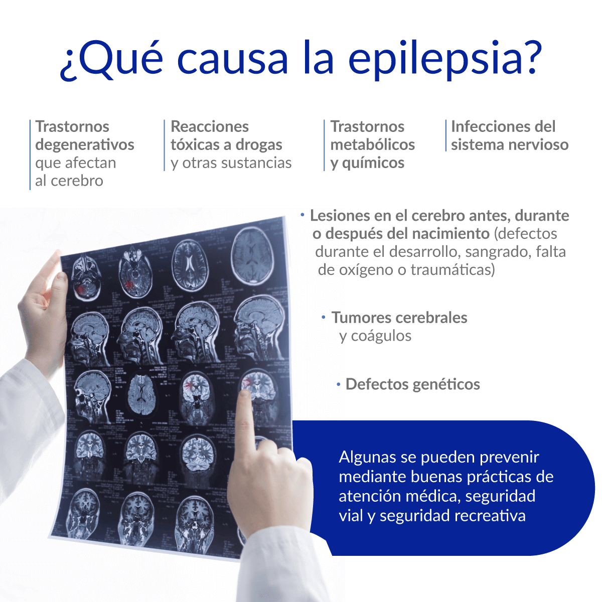 �Qu� causa epilepsia?