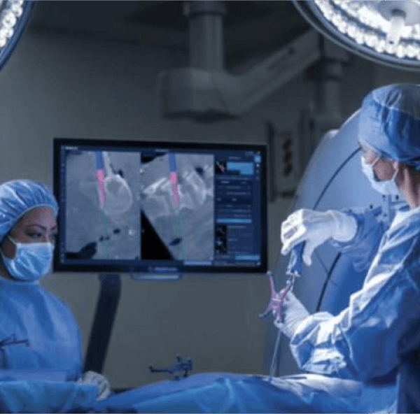 Sistema O-arm, visualizaci�n de cirug�as de la columna vertebral en tiempo real