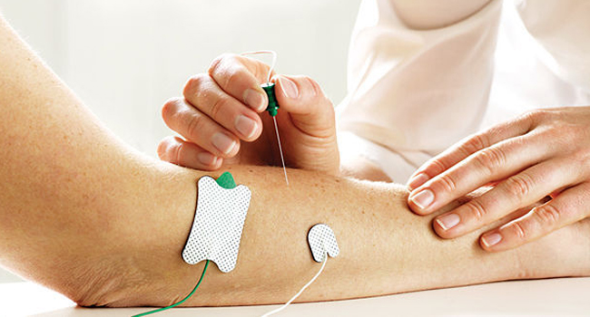 Doctora haciendo electromiografía a paciente.