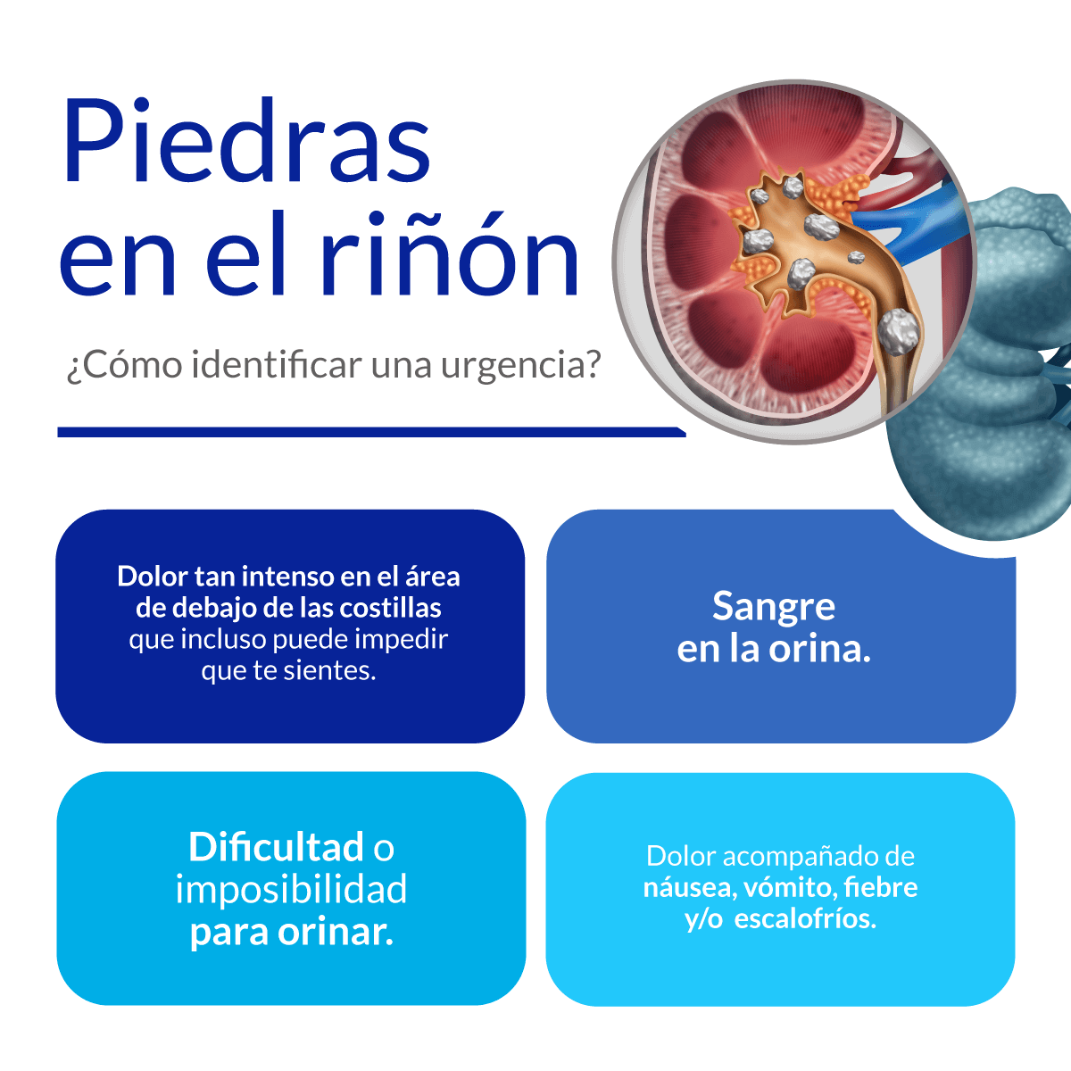Piedras en el ri�on